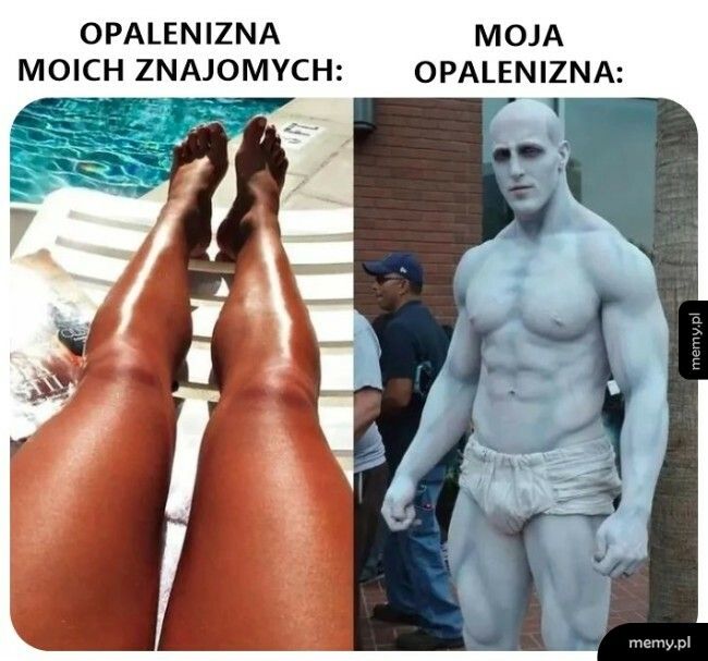 Opalenizna