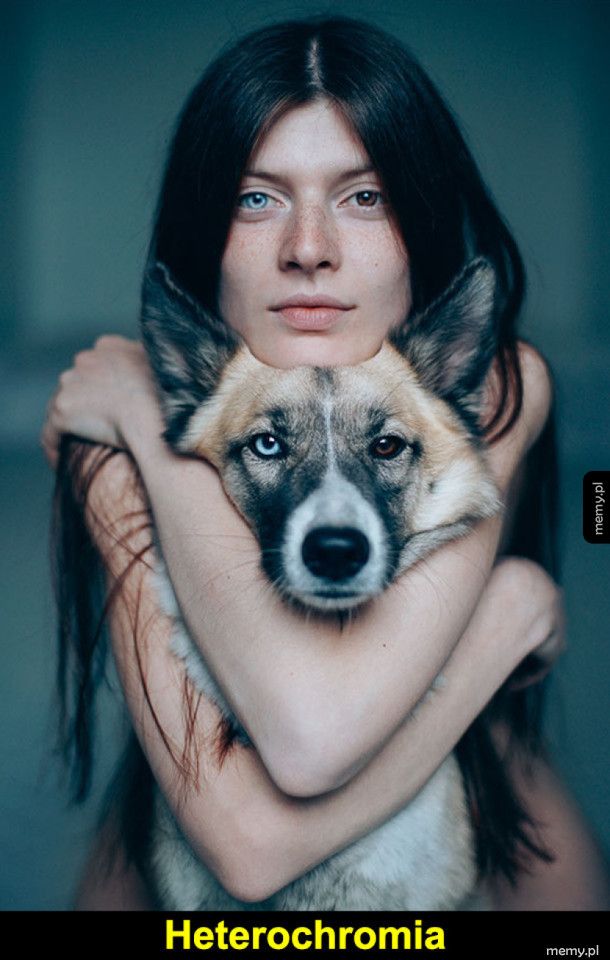 Heterochromia