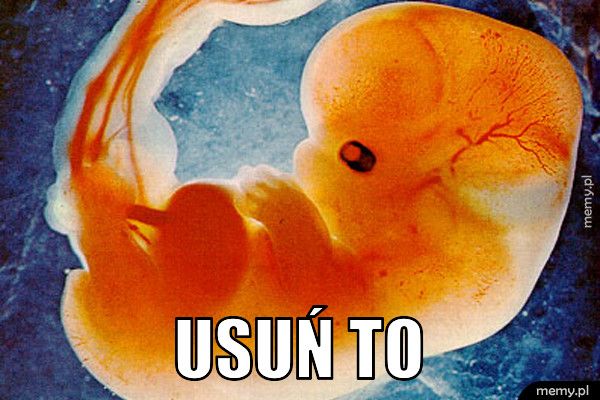  USUŃ TO