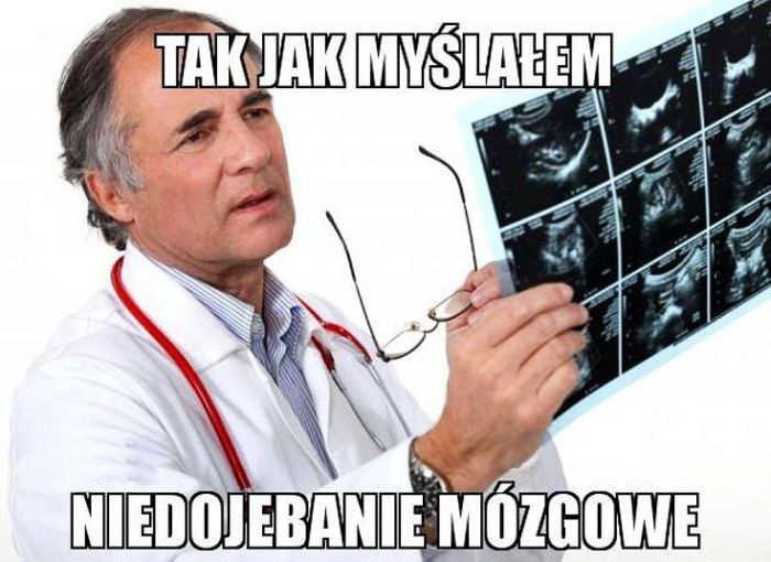 Niedojebanie xD