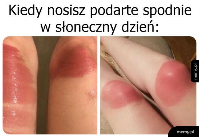 Troszkę przypaliło