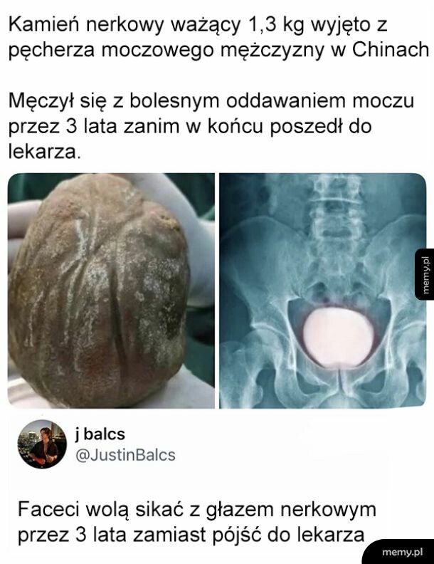 Poczekajmy, może samo przejdzie